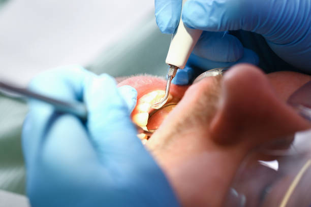 Best Emergency Dental Care for Broken or Chipped Teeth in Lakeway, TX