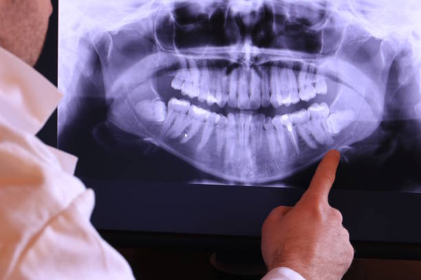 Best Emergency Treatment for Dental Infections or Abscesses in Lakeway, TX